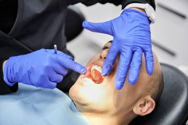 Best Emergency Root Canal Therapy in Silver Grove, KY